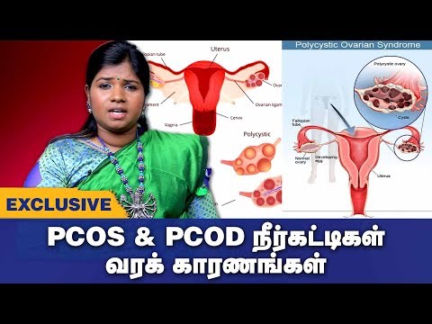 pcod-&-pcos-symptoms-&-treatment-in-tamil-|-pcod-&-pcos-siddha-treatment-|-tamil-health-tips