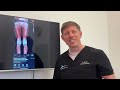 This Knee Pain Ain’t It: What’s Really Going On? 😩🔍