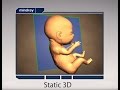 Step by Step to Get Perfect 3D/4D Baby Image