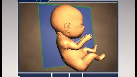 Step by Step to Get Perfect 3D/4D Baby Image
