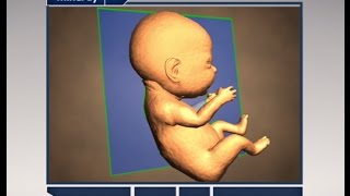 Step by Step to Get Perfect 3D\/4D Baby Image