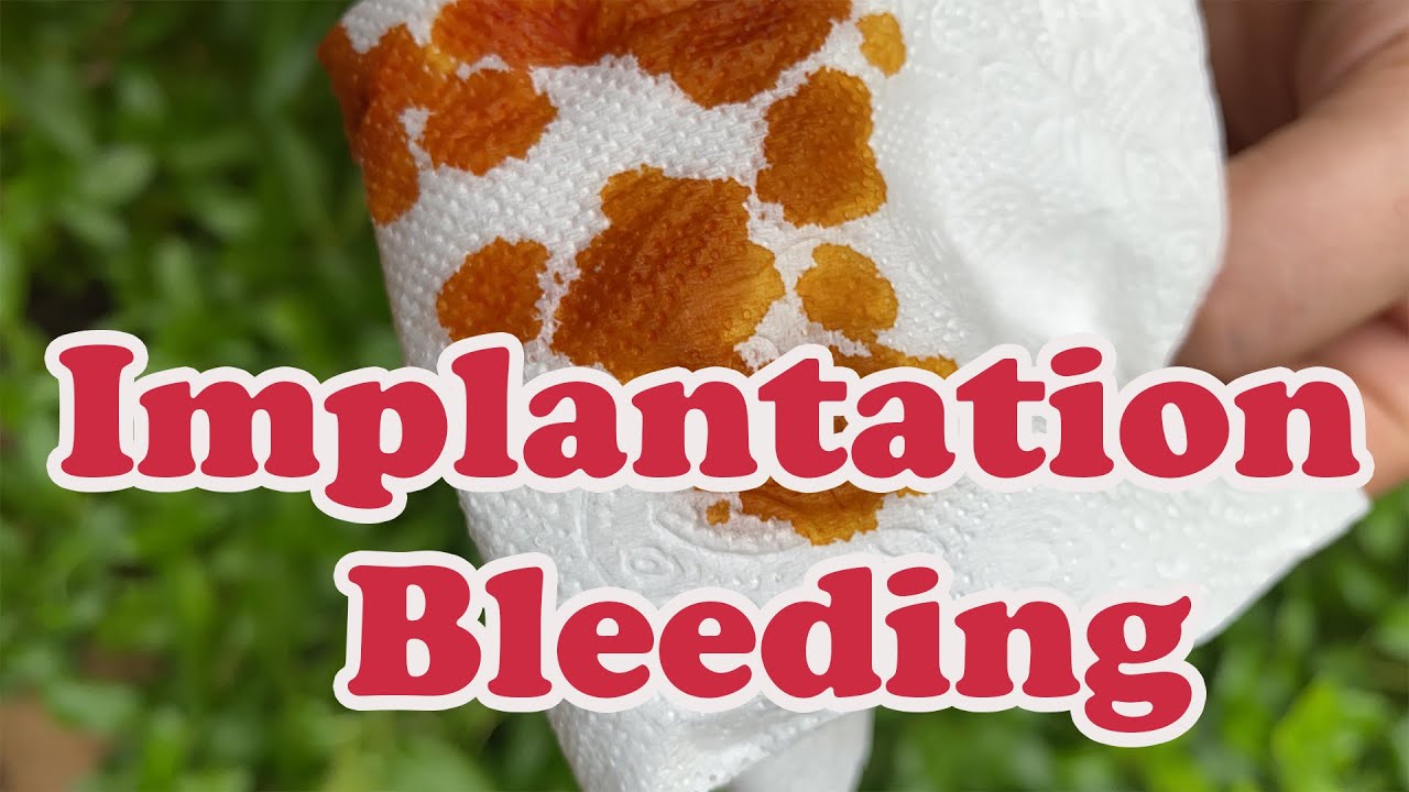 implantation bleeding pregnancy ️ Here's everything to know about it