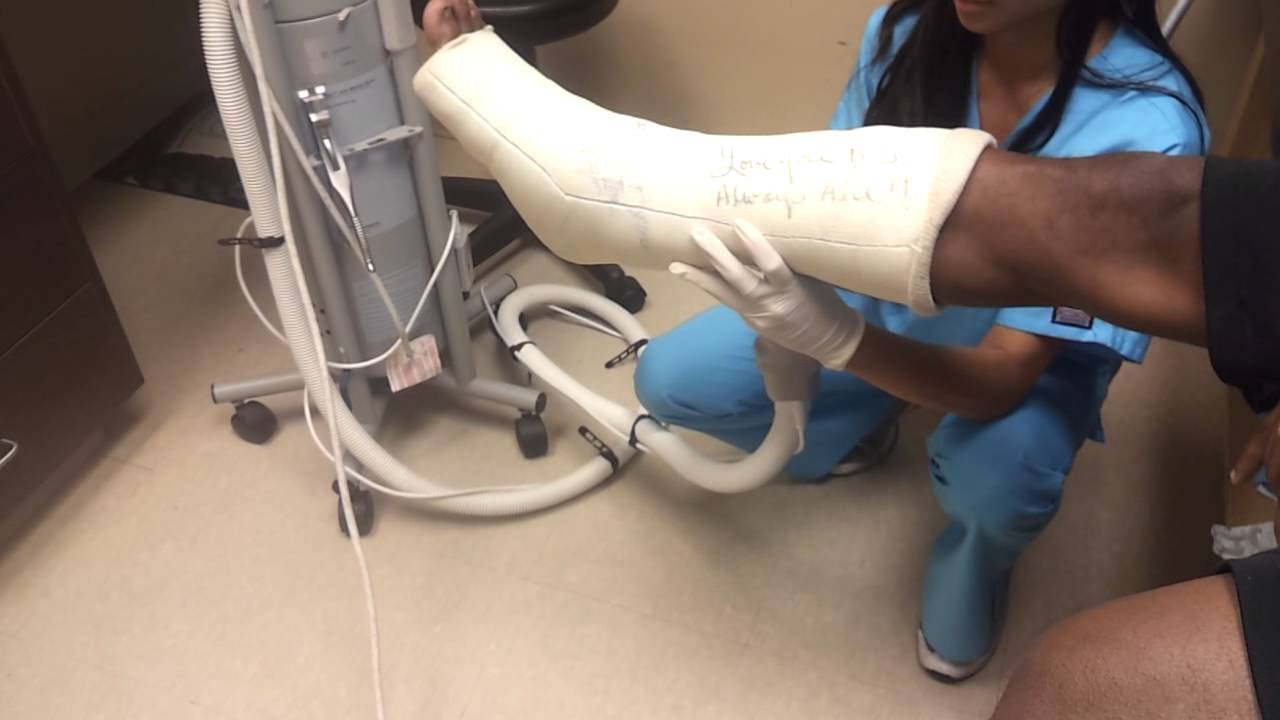 Achilles Rupture Video 7 1 3 Weeks Post op YouTube