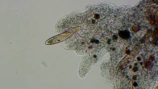 Amoeba Stalks And Captures Paramecia To Original Music