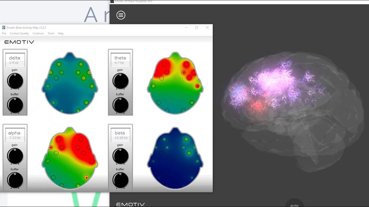 Sounds of EDM on the Brain.