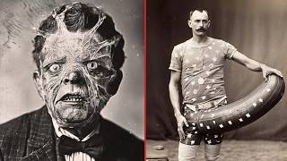 15 Bizzare Circus Freaks Banned From History Rare Photos & Untold Stories