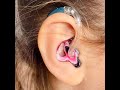 Shocking Truth Revealed: 10 Medical Reason why People Hate Hearing Aids