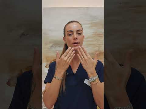 Surco Nasogeniano y arrugas de marioneta en clínicas EB #surconasogeniano#clinicaelenaberezo