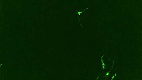 Neural progenitor cell differentiation D9 4