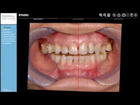 DSS - Teeth Library