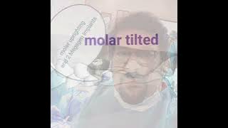 MEGAGEN IMPLANT - tited molar