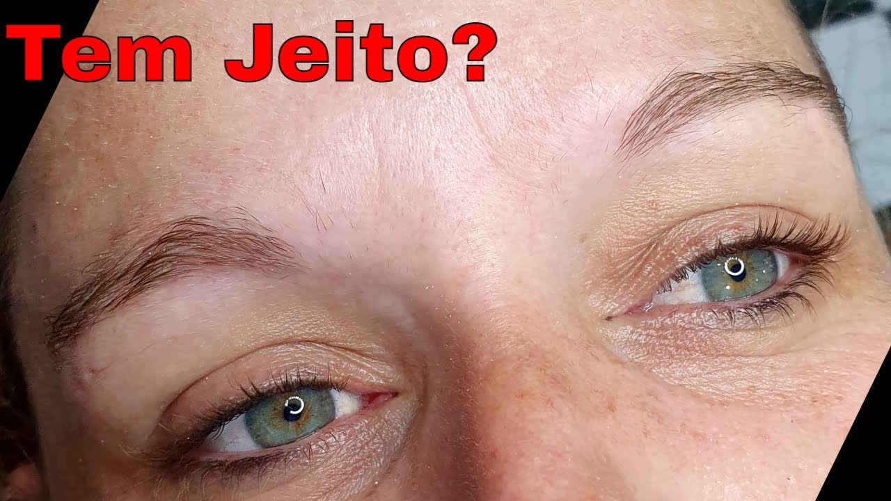 Sobrancelha fio a Fio Transformação Total (Não Tinha Sobrancelha Microblading ) com Tebori Sem Dor