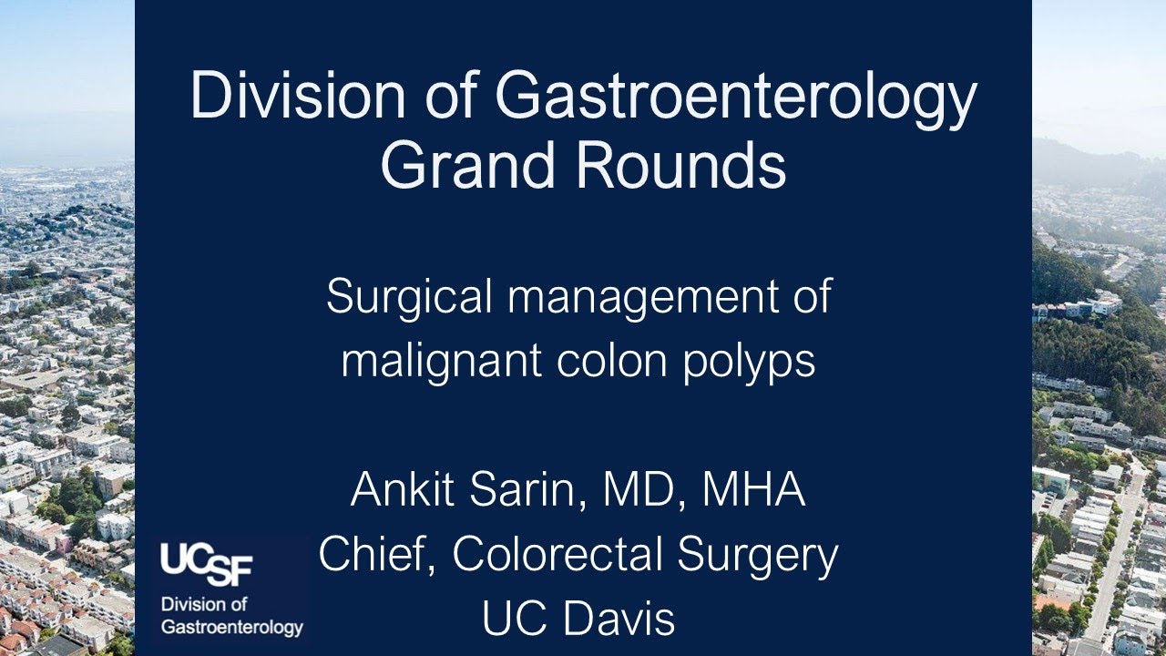 Surgical management of malignant colon polyps - Ankit Sarin, MD, MHA ...
