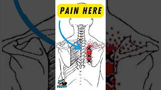 Upper back trigger point Immediate pain relief #triggerpoint #sciaticapainrelief #backpain #gym