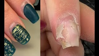 Жуткие отслойки😱Думала не исправлю😐Причины отслоек гель лака💅Преображение ногтей