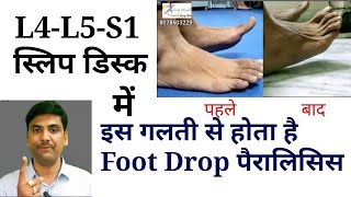 l4 l5, l5 s1 disc bulging में foot drop से कैसे बचें ? || foot drop treatment exercises screenshot 3