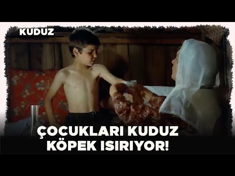 Kuduz Türk Filmi  |  Çocukları Kuduz Köpek Isırıyor!