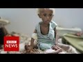 Yemen: On the brink of starvation - BBC News