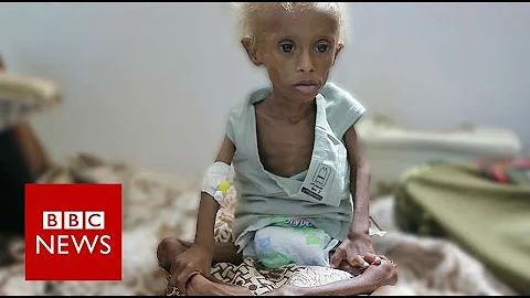 Yemen: On the brink of starvation - BBC News - DayDayNews