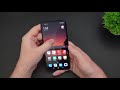 Xiaomi Mi 11 Lite First 10 Things to Do!