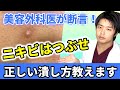 ニキビはつぶすべき！？美容外科医が間違った常識を切る！