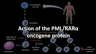 Action of the PML RAR alpha oncogene protein