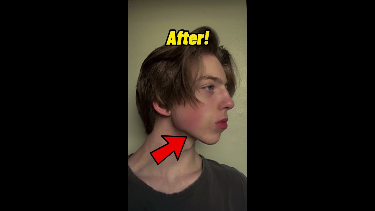 How To Get A Jawline