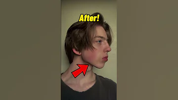 How To Get A Jawline 