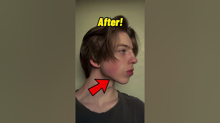 How to get a jawline