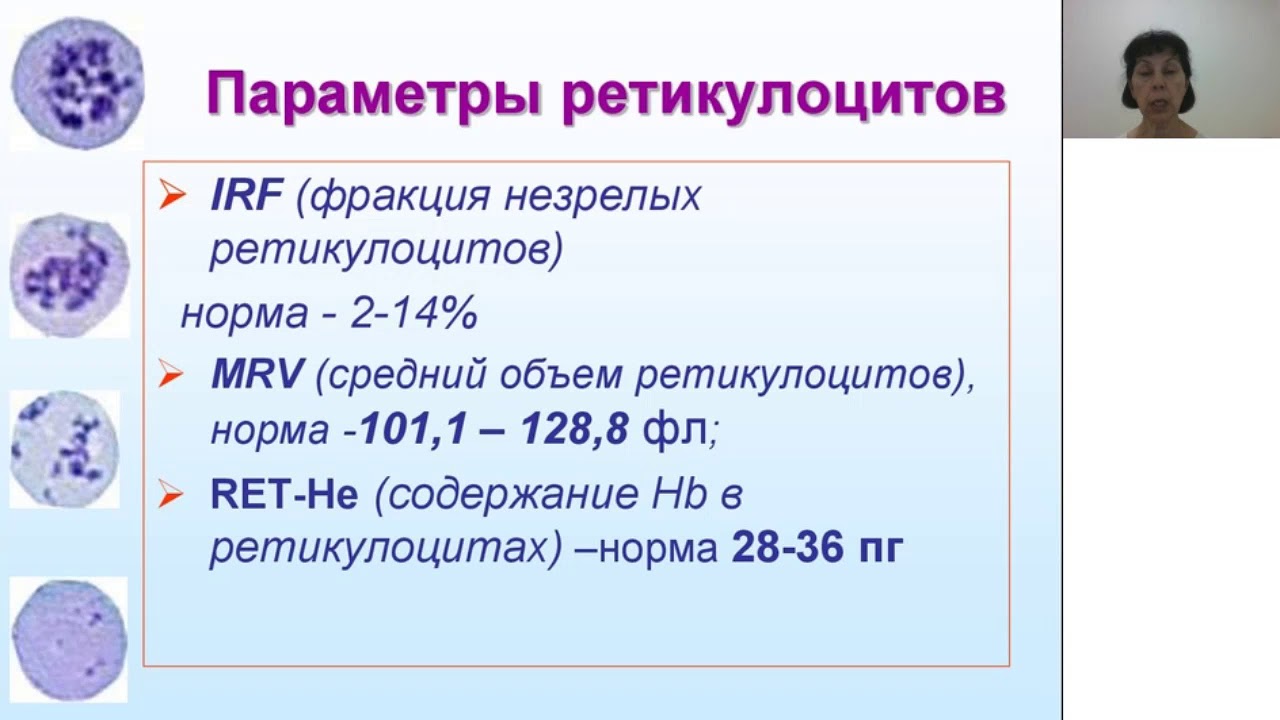 Повышение ретикулоцитов в крови. Ретикулоциты микроскопия норма. Стадии зрелости ретикулоцитов. Нормальные показатели ретикулоцитов периферической крови в %. Фракция незрелых ретикулоцитов.