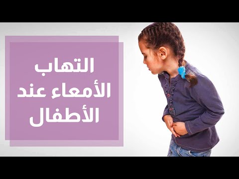 فيديو: 4 طرق للتعرف على أعراض متلازمة داون