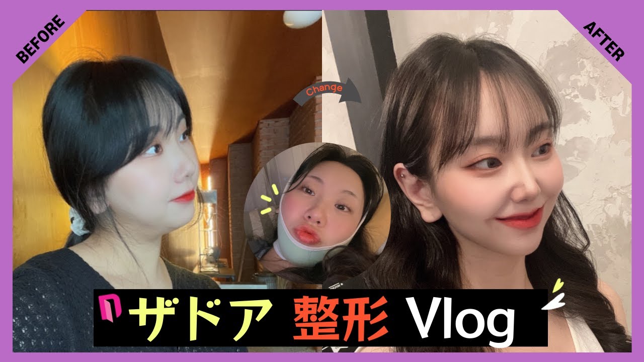 [ペリカン手術🦜]ザドア二重顎筋肉縛り💉