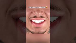 Download Lagu Te-ai gândit vreodată cât de mult contează zâmbetul tău? ✨ MP3 Download Lagu Te-ai gândit vreodată cât de mult contează zâmbetul tău? ✨ MP3