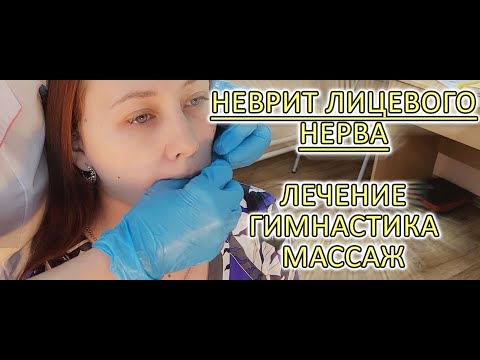 Что делать при неврите лицевого нерва!!!