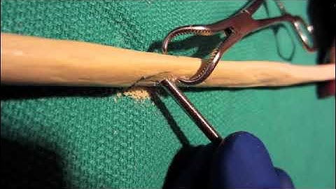 Dynamic Compression Plate and Lag Screw Technique | Dr Junaid Ahmad Consultant Plastic Surgeon