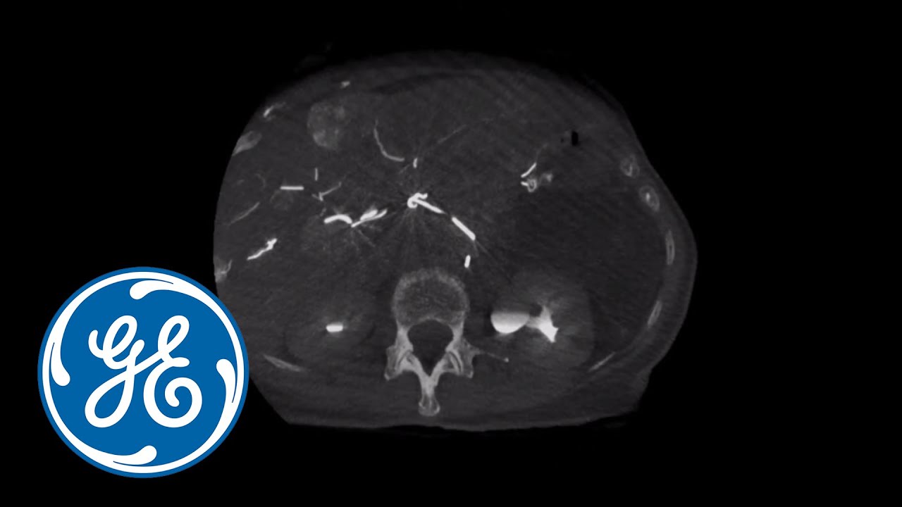 mrid дикий яд ремикс GE Healthcare Liver Assist V.I. Full