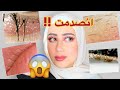 شوفوا بشرتي و اشياء ثانيه كيف شكلها تحت الميكروسكوب😱 انصدمت !! || شهد ناصر 🌸