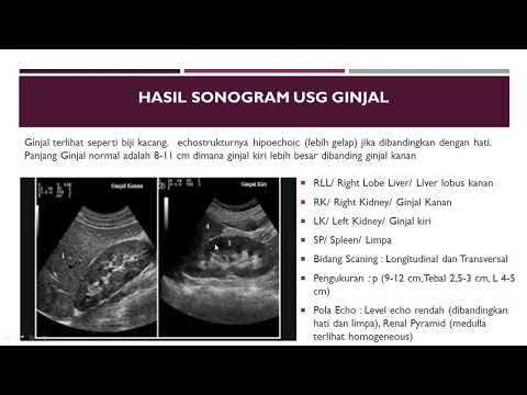 Teknik Pemeriksaan USG (Ultrasonografi) Ginjal, Kidney, renal