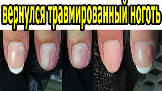 ❤ ВЕРНУЛСЯ ТРАВМИРОВАННЫЙ ноготь ❤ РЕКОНСТРУКЦИЯ ❤ПРОТИВОГРИБКОВЫЙ гель IMPULS ❤ КИСТЬ для ФРЕНЧА ❤ ❤ ВЕРНУЛСЯ ТРАВМИРОВАННЫЙ ноготь ❤ РЕКОНСТРУКЦИЯ ❤ПРОТИВОГРИБКОВЫЙ гель IMPULS ❤ КИСТЬ для ФРЕНЧА ❤