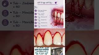 दांतों से खून आने के कारण और उपचार | Bleeding Gums Treatment | Dental Care Tips#shorts #trending