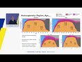 Macroeconomic implications of changes in euro area labor markets | 2025 ECB Forum on Central Banking