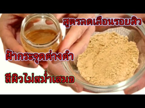 สูตรมาร์คหน้าลดรอยสิวด้วยขิง Facial mask recipe to reduce acne scars with ginger