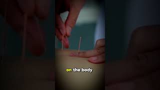 The Impact of Acupuncture on Blood Sugar Control: Diabetes and Glucose Management