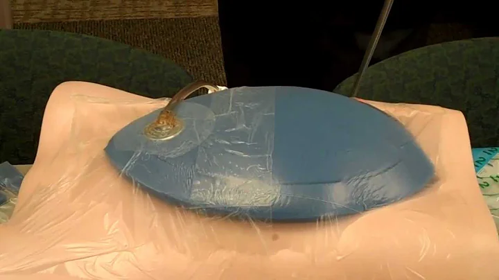 Damage Control: Applying the KCI ABThera