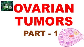 OVARIAN TUMORS -  Part 1 : Classification