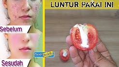 BUKAN SULAP !!! WAJAH PENUH JERAWAT BATU,BRUNTUSAN DAN FLEK HITAM MUSNAH SELAMANYA - Durasi: 4.34. 