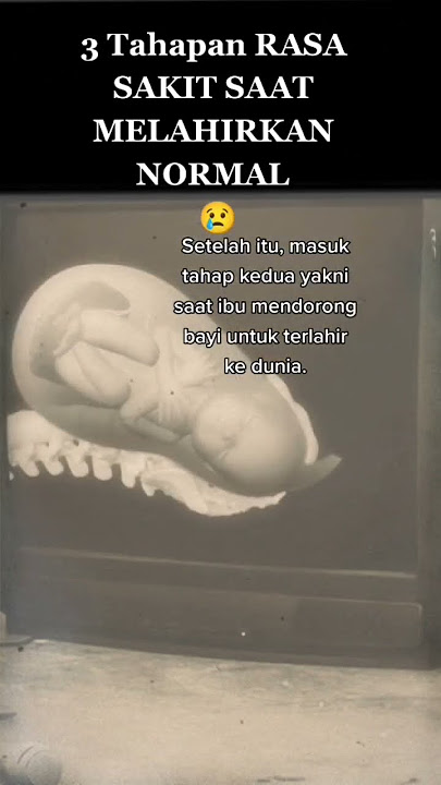 Nyeri Saat Ibu Melahirkan Normal