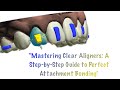 Mastering Clear Aligners: A Step-by-Step Guide to Perfect Attachment Bonding