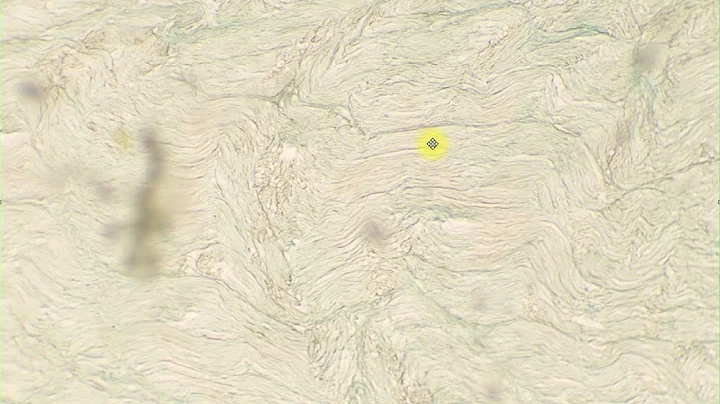 Unmyelinated axons Nerve trunk LS