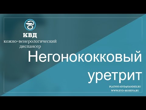 370  Негонококковый уретрит